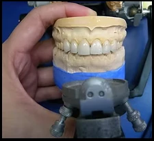Trabajo realizado en el laboratorio dental de Lau Dental